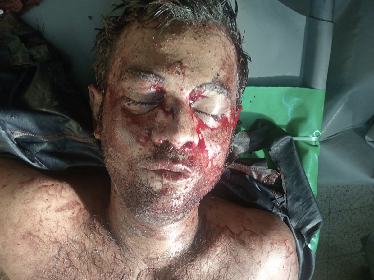 যশোরে সন্ত্রাসী জিতুকে কুপিয়ে জখম, ঢাকায় রেফার
