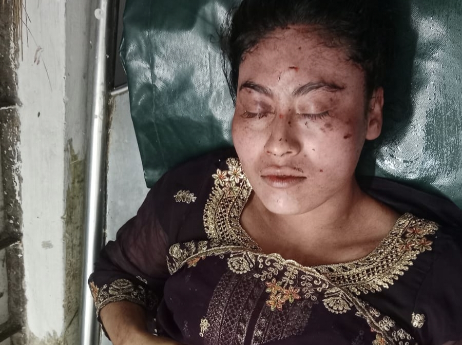 যশোরে তালাকপ্রাপ্ত স্ত্রীকে ছুরিকাঘাত