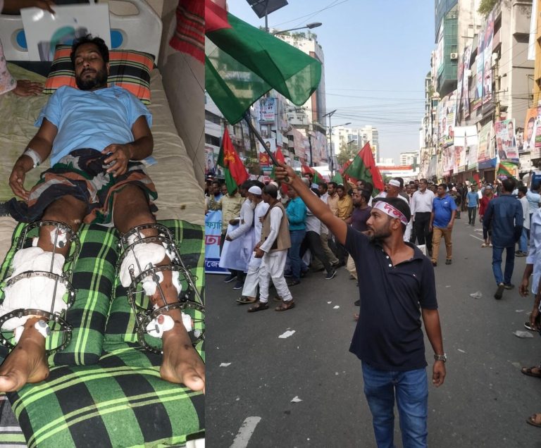 ছাত্ররাজনীতি থেকে যুবদল, ১৭ বছরের লড়াই শেষে মহিদুলের নিঃসঙ্গ জীবন  আন্দোলন-সংগ্রামে ছিলেন সক্রিয় , হামলার পর শারীরিক ও আর্থিক সংকটে ঘরবন্দী