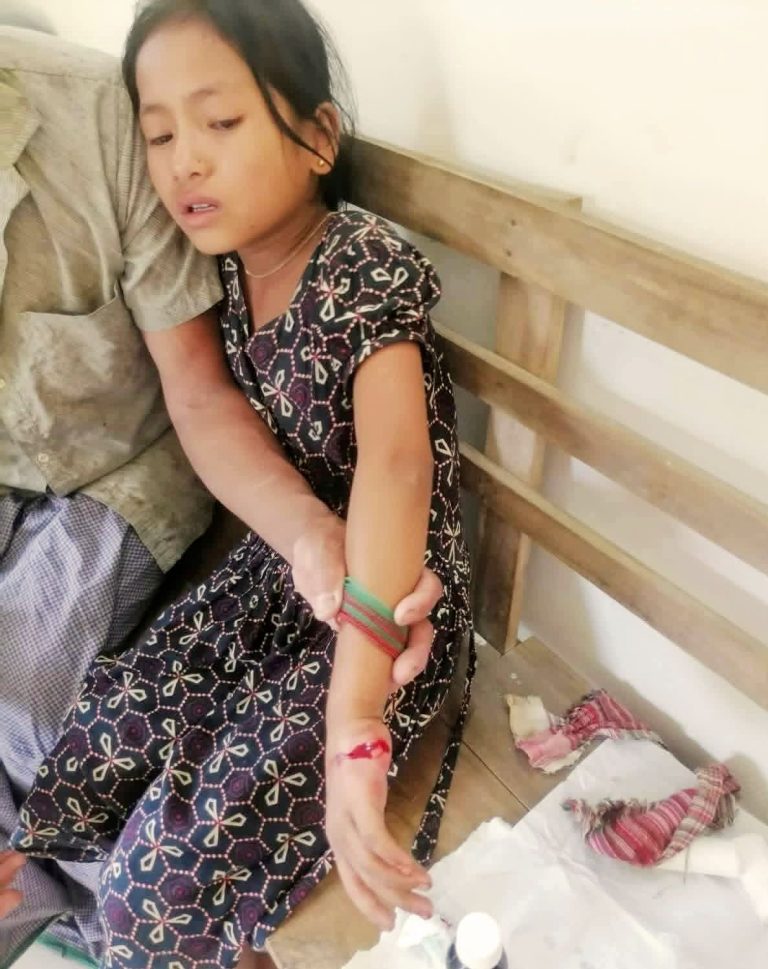 সাজেকে পিসিজেএসএস- ইউপিডিএফ’র আধিপত্যর লড়াইয়ে শিশু গুলিবিদ্ধ