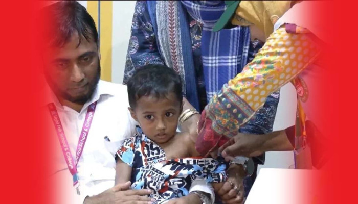 আজ থেকে শুরু হামের বিশেষ টিকা ক্যাম্পেইন, পাবে ৩৪ লাখ শিশু