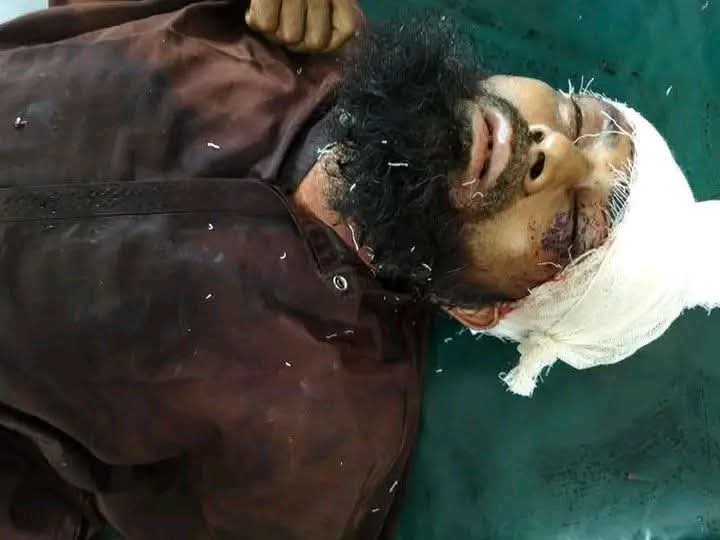 ফেনীর ছাগলনাইয়ায় অটোরিক্সাচালককে কুপিয়ে হত্যা