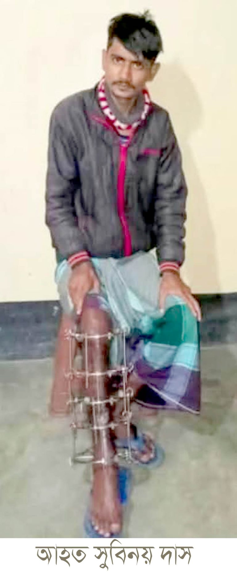 সুনামগঞ্জে সড়ক র্দূঘটনায় গুরুতর আহত মোটর সাইকেল চালক সুবিনয়ের অপারেশনের জন্য দু”লাখ টাকা আর্থিক সহায়তার আবেদন